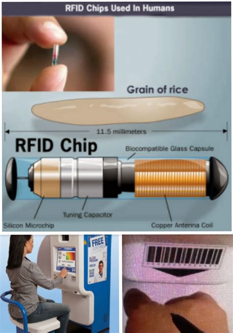 do any other countries have rfid chips in their citizens|rfid chip implants for pets.